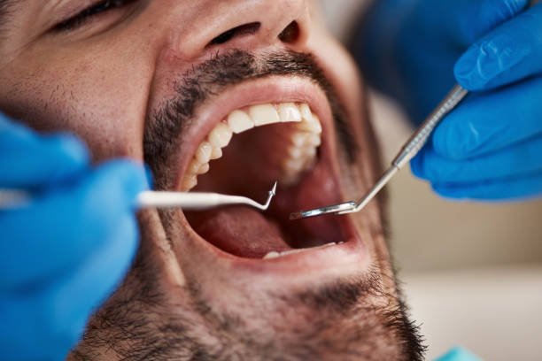 Best Teeth Whitening  in Hobart, OK